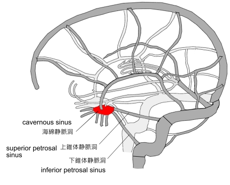 何が原因でしょうか?